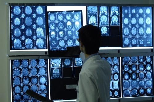 признаки эпилептических припадков на МРТ